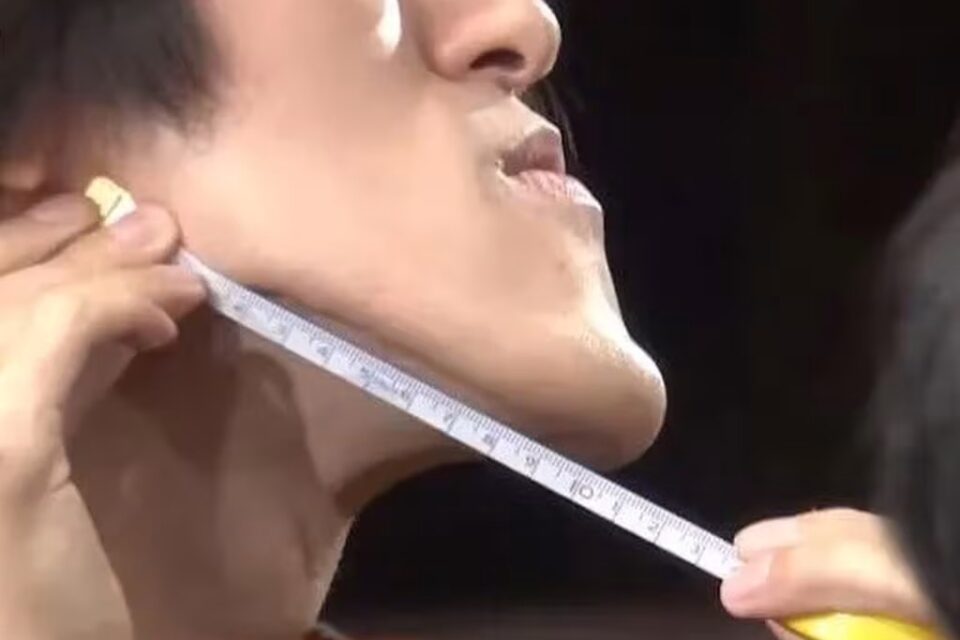 Homem Japonês com o queixo mais longo do mundo dá dicas de autoestima; fotos Jonouchi mandíbula passou a crescer de forma inesperada