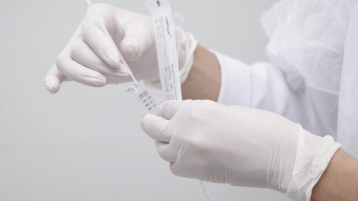 Solicitação ou não do teste de Influenza é uma decisão do médico, mediante a avaliação do quadro e possibilidades de diagnósticos, diz SMS