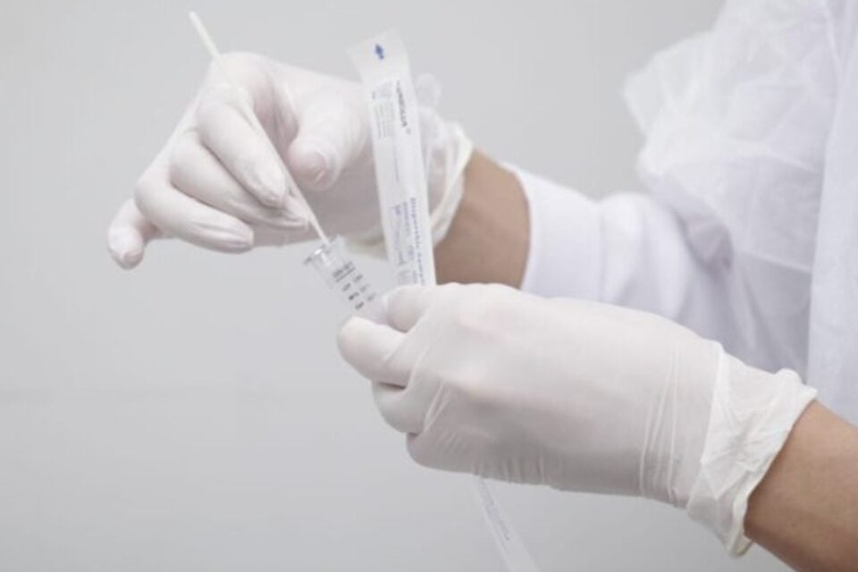 Solicitação ou não do teste de Influenza é uma decisão do médico, mediante a avaliação do quadro e possibilidades de diagnósticos, diz SMS