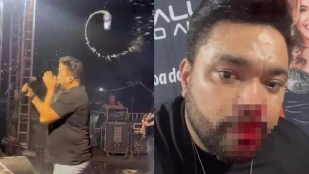 Vídeo: Cantor fica ferido após ser atingido por lata durante show em Mato Grosso Rick Rocha, vocalista da Banda Malla 100 Alça, ensaguentado