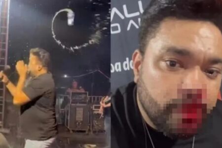 Vídeo: Cantor fica ferido após ser atingido por lata durante show em Mato Grosso Rick Rocha, vocalista da Banda Malla 100 Alça, ensaguentado