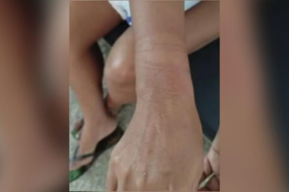 Imagem das marcas nos punhos da vítima