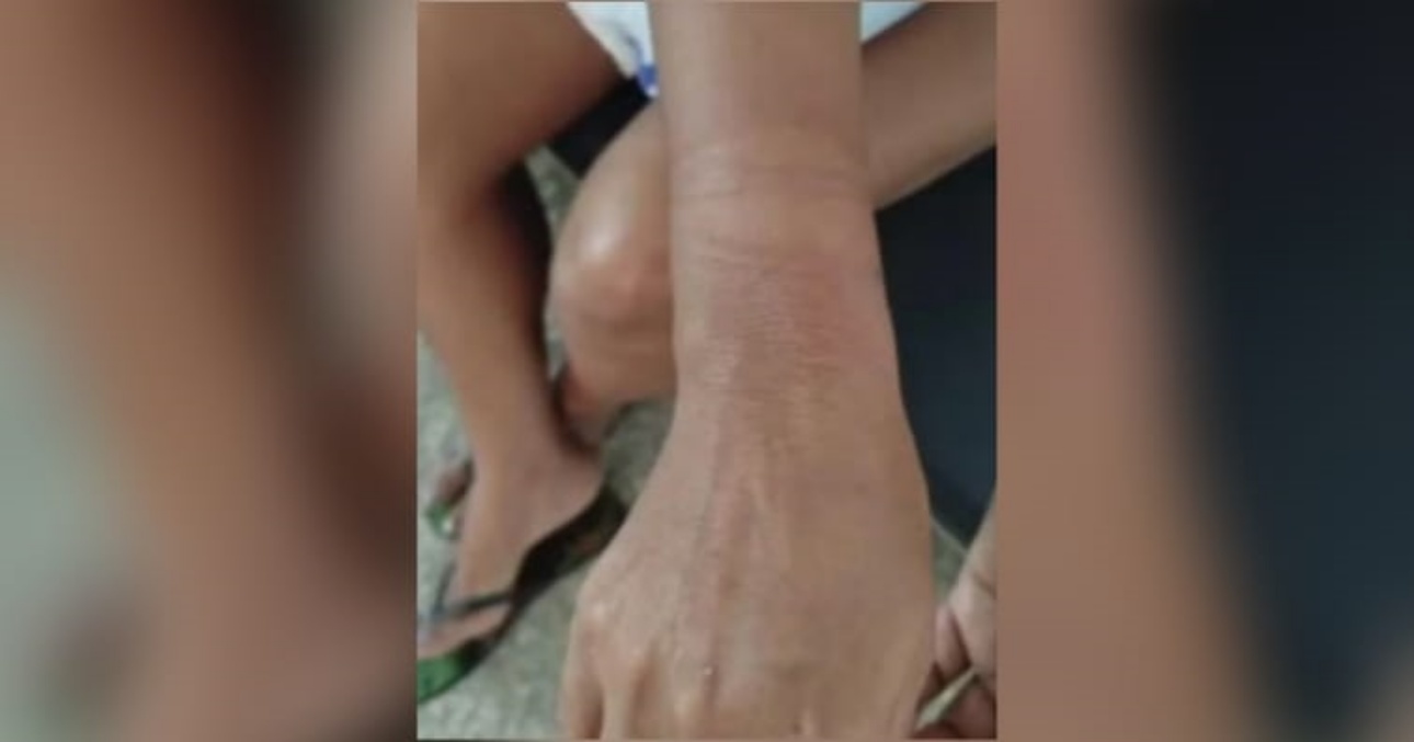 Imagem das marcas nos punhos da vítima