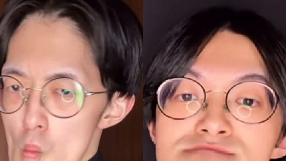 Homem Japonês com o queixo mais longo do mundo dá dicas de autoestima; fotos Jonouchi mandíbula passou a crescer de forma inesperada