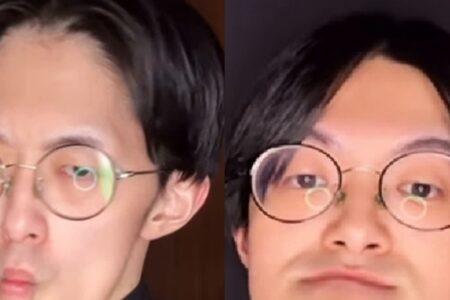 Homem Japonês com o queixo mais longo do mundo dá dicas de autoestima; fotos Jonouchi mandíbula passou a crescer de forma inesperada