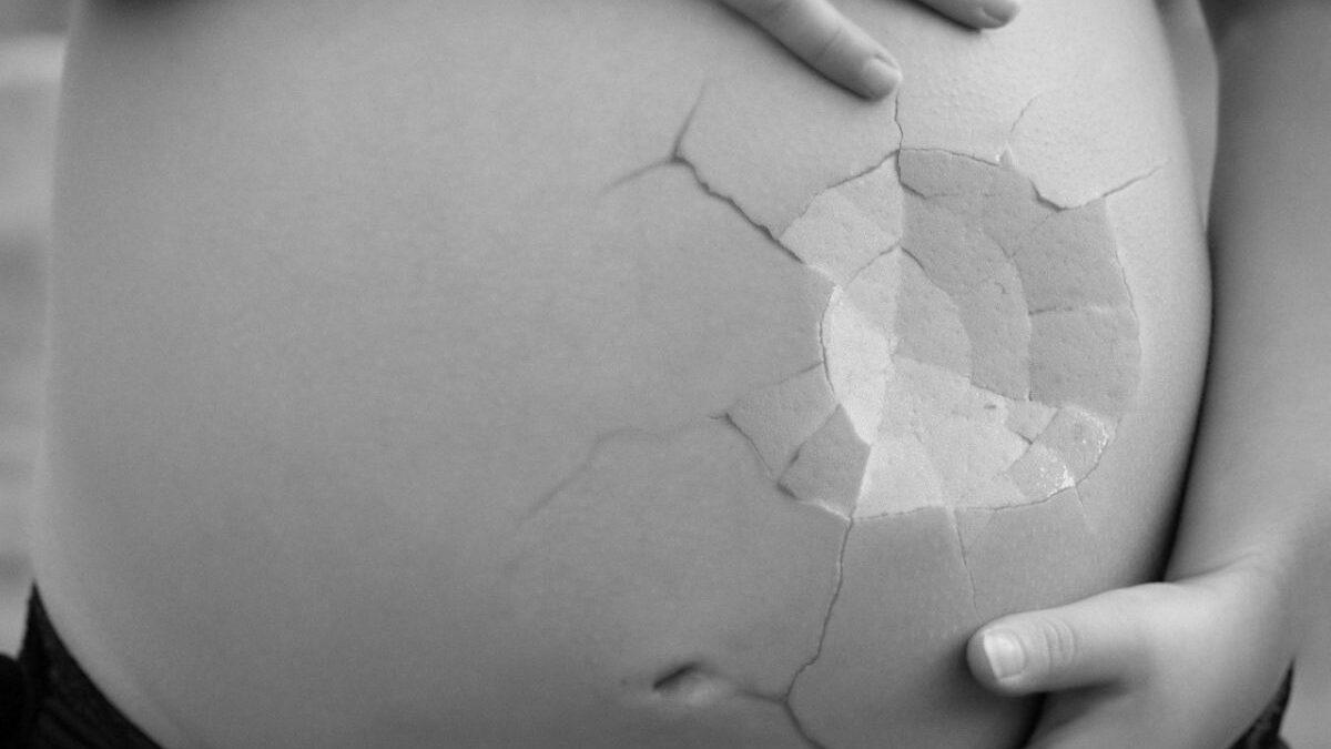 Aborto: mais de 200 mulheres presas no Brasil (Foto: Pixabay)