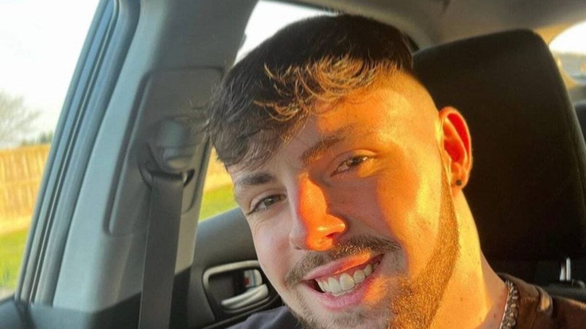 revistapazes.com - Homem fica com o rosto deformado ao ignorar proibição médica inusitada após transplante capilar