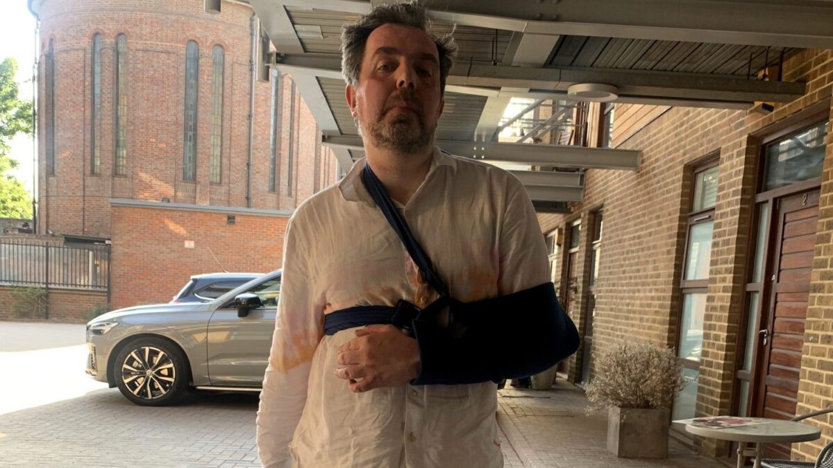 Homem conhecido por ter 'o maior pênis do mundo' sofre acidente em banheiro por causa do órgão Britânico teve duas fraturas no braço esquerdo