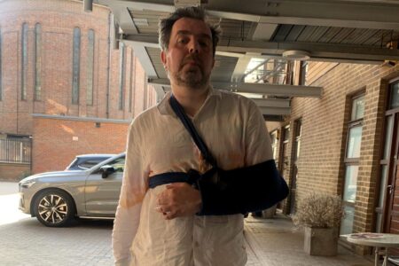 Homem conhecido por ter 'o maior pênis do mundo' sofre acidente em banheiro por causa do órgão Britânico teve duas fraturas no braço esquerdo