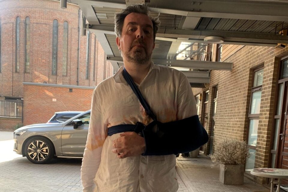 Homem conhecido por ter 'o maior pênis do mundo' sofre acidente em banheiro por causa do órgão Britânico teve duas fraturas no braço esquerdo