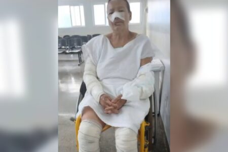 Idosa é atacada por pitbull em Anápolis