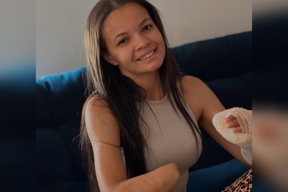Foto da jovem atacada pelo ex