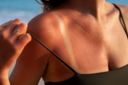 Mulher é demitida por justa causa após fazer bronzeamento artificial durante atestado médico caso aconteceu em Belo Horizonte