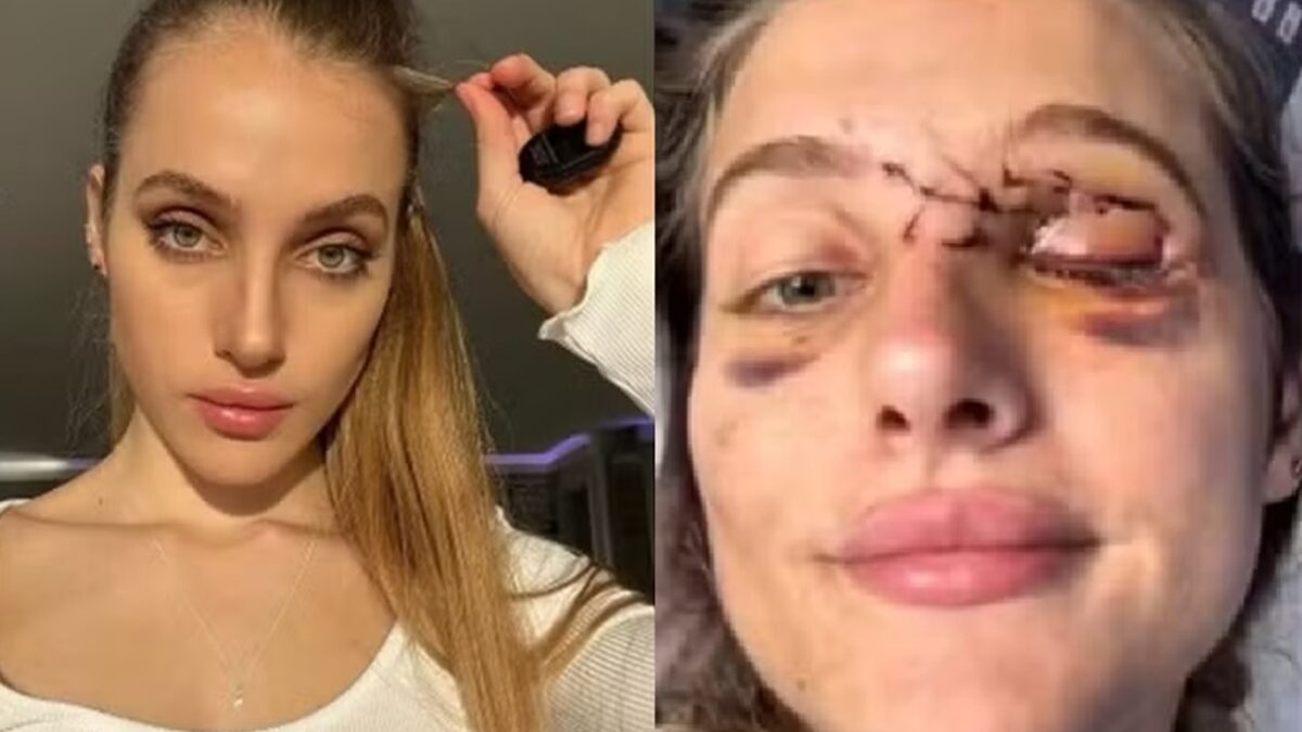Famosa do Onlyfans sofre acidente de moto ao ser atingida por pombo e perde a memória O impacto violento de Mercedes Valentine foi lançada