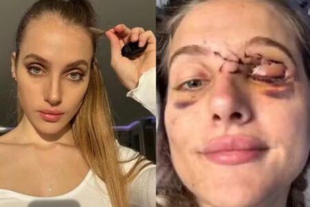 Famosa do Onlyfans sofre acidente de moto ao ser atingida por pombo e perde a memória O impacto violento de Mercedes Valentine foi lançada