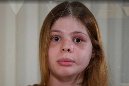 Médica espancada por namorado em São Paulo diz que ele ficou com ciúme de homem gay