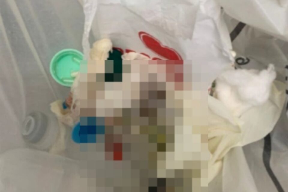 Imagem dos materiais descartados na UPA