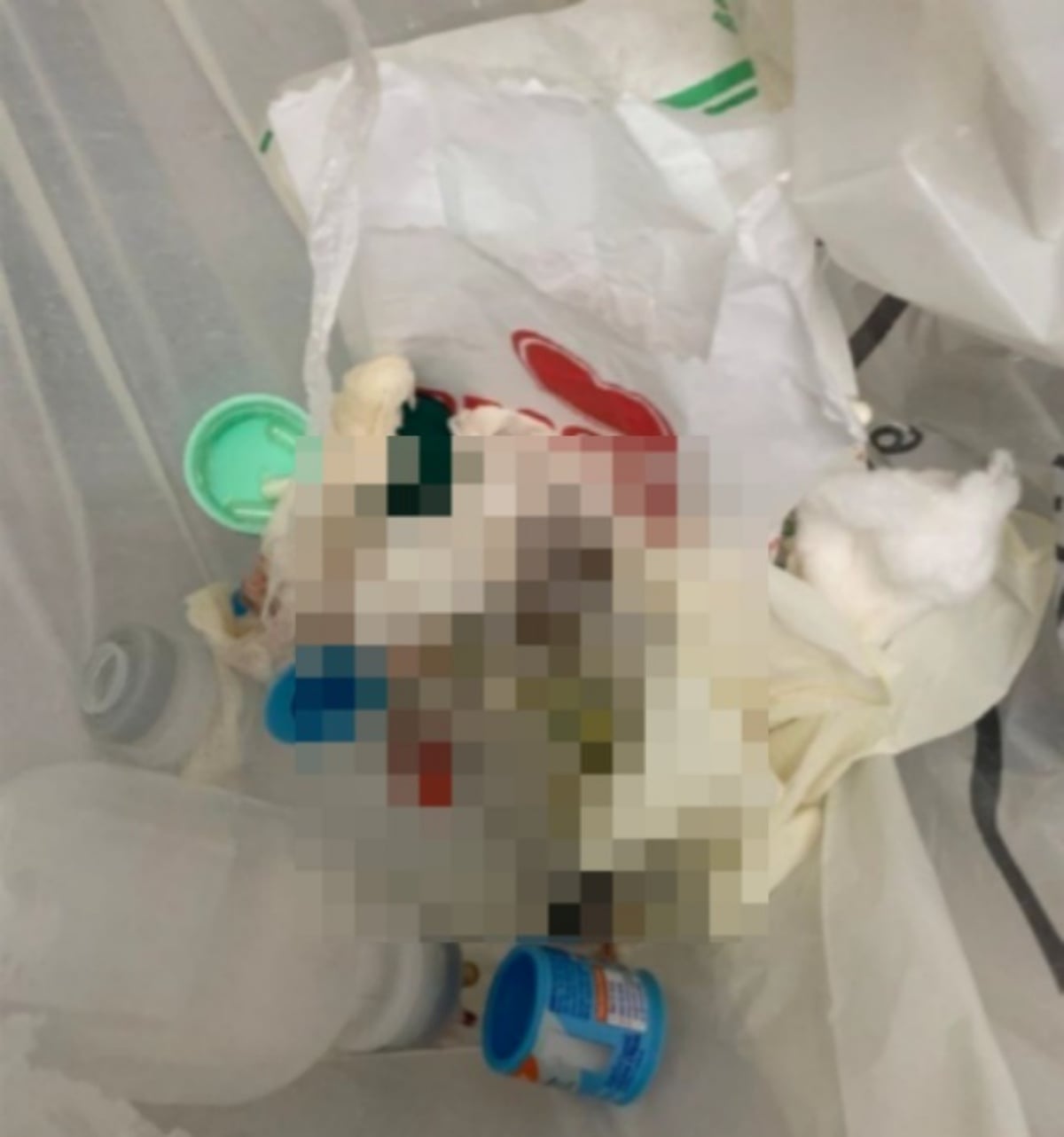 Imagem dos materiais descartados na UPA