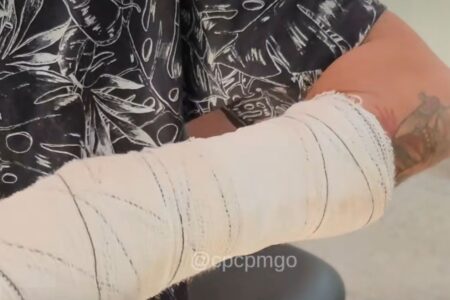 Confusão generalizada aconteceu na Vila Brasília Jovem tem braço quebrado após marcar briga de torcidas pela internet