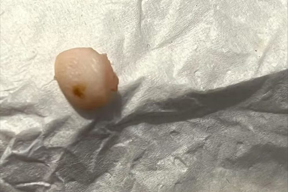 Mulher encontra ponta de dedo humano em wrap de frango servido em restaurante; veja foto