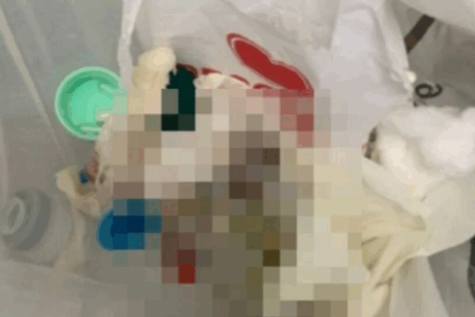 Casal é denunciado por provocar aborto em quarto de motel em Ceres