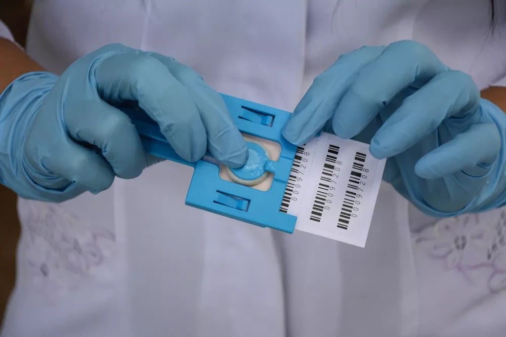 Imagem do material usado para mapear o perfil genético