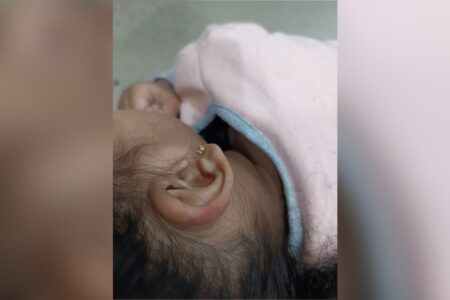 Ferimento na orelha da criança