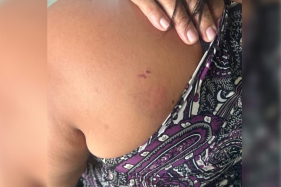 Mulher é agredida pela namorada após surto de ciúmes em Rio Verde