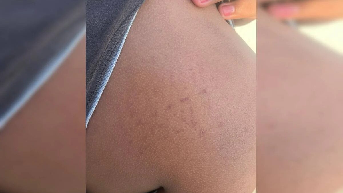 Mulher é presa por torturar o filho de 14 anos em Águas Lindas de Goiás