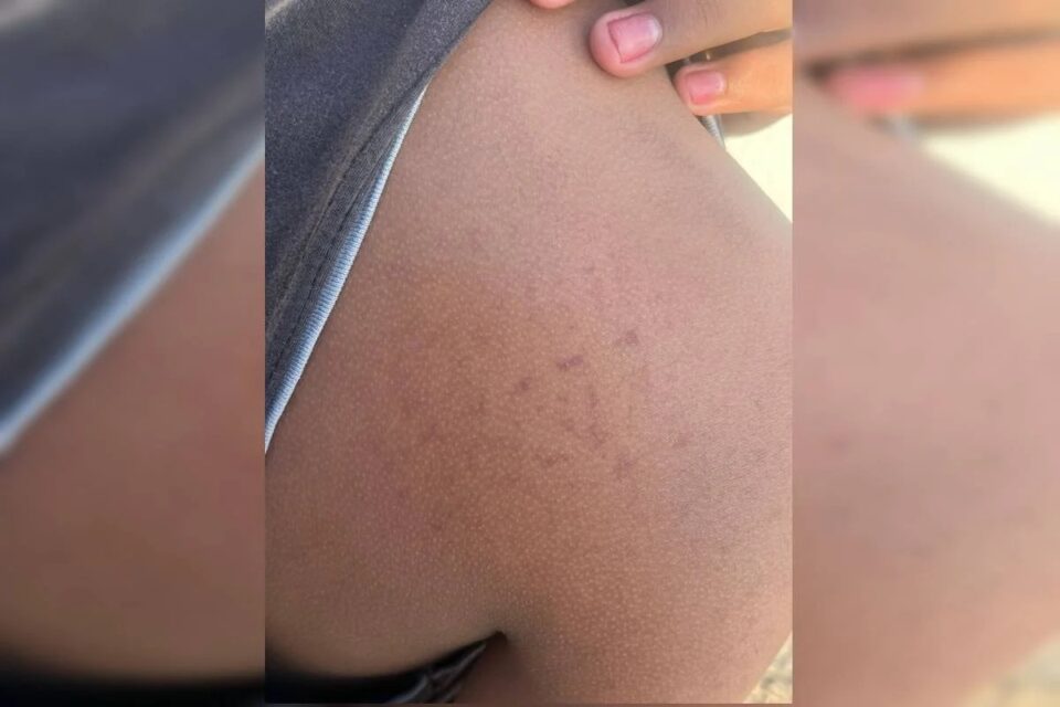 Mulher é presa por torturar o filho de 14 anos em Águas Lindas de Goiás