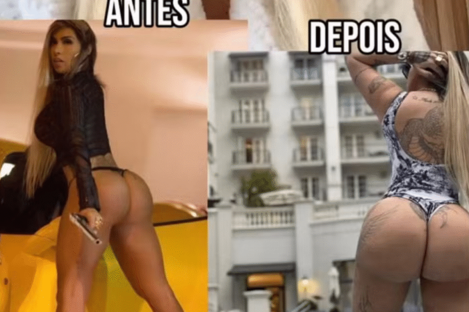 71fa40f3 image Imagens fortes: Juju Ferrari mostra bumbum vazando hidrogel após infecção; fotos