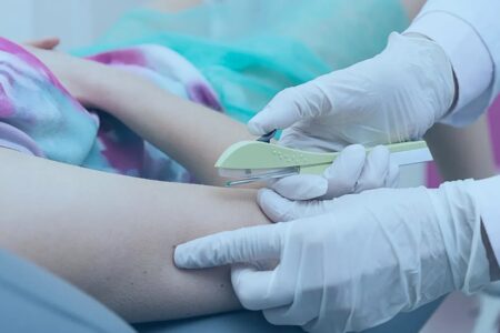 Ministério da Saúde recebe primeiras unidades de implante contraceptivo para o SUS único implante hormonal com registro sanitário na Anvisa