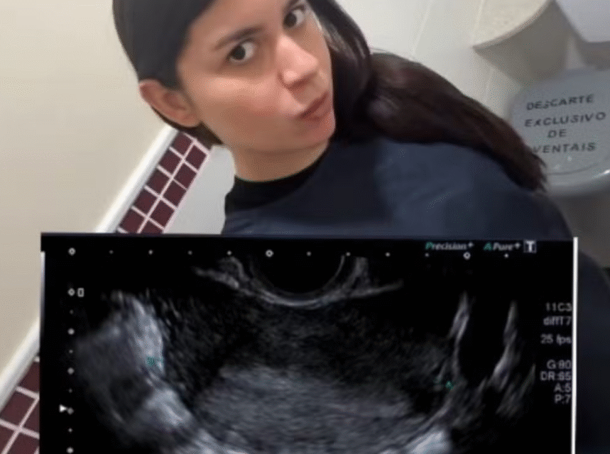 8df8ea74 image Jovem relata que DIU sumiu e não foi localizado em exames; veja o que aconteceu