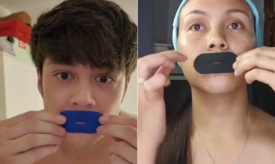 Dormir com a boca tapada: nova moda nas redes sociais viraliza e preocupa médicos reduzir o ronco, o mau hálito e melhora a qualidade do sono