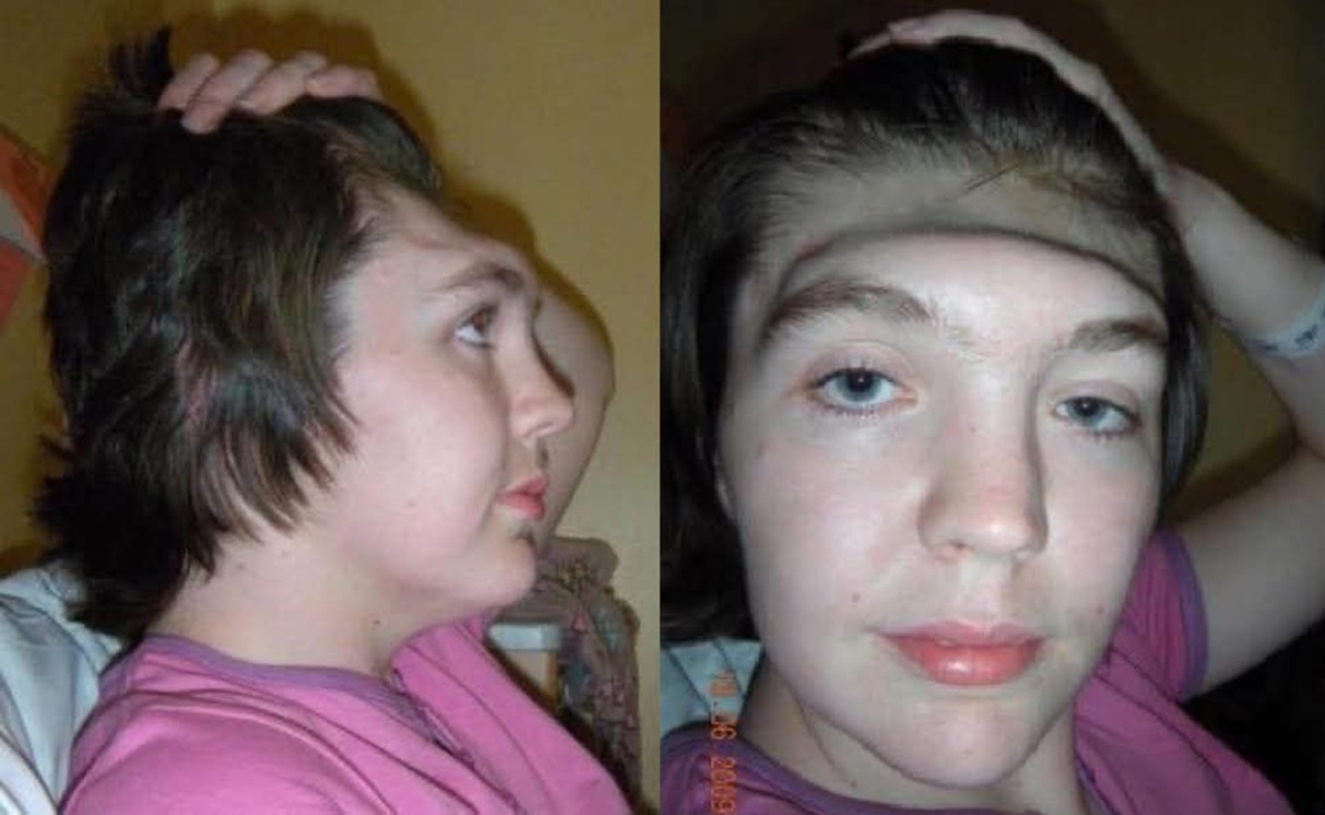 Mulher perde a testa em acidente de carro e faz alerta sobre erro