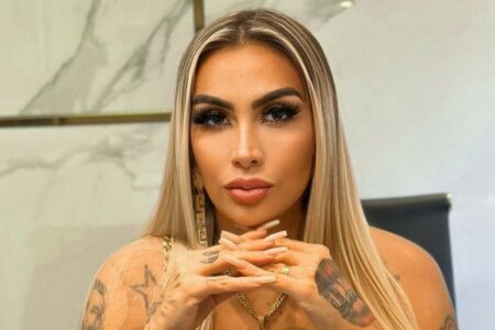 Juju Ferrari mostra bumbum vazando hidrogel após infecção fotos Modelo grávida internada após complicações por silicone industrial