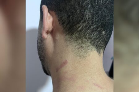 Advogado denuncia agressão de servidor do fórum de Valparaíso; TJ e OAB acompanham caso