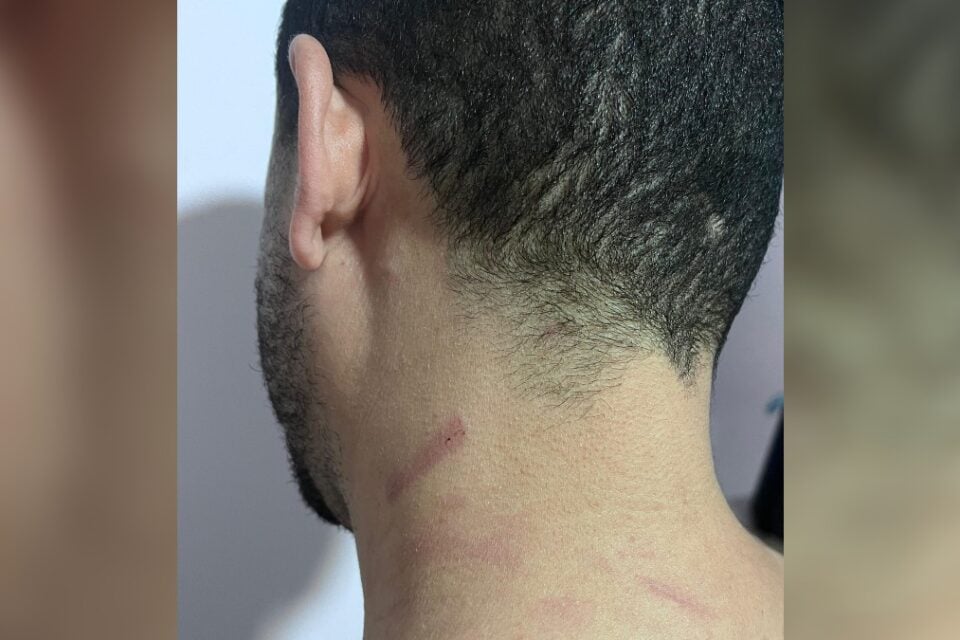 Advogado denuncia agressão de servidor do fórum de Valparaíso; TJ e OAB acompanham caso