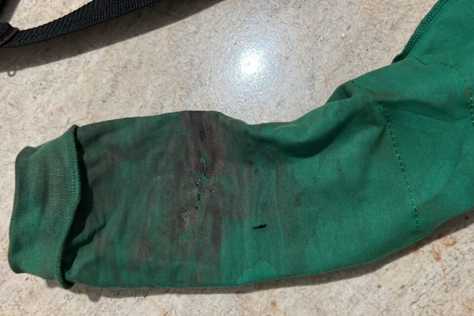 Imagem da manga da blusa