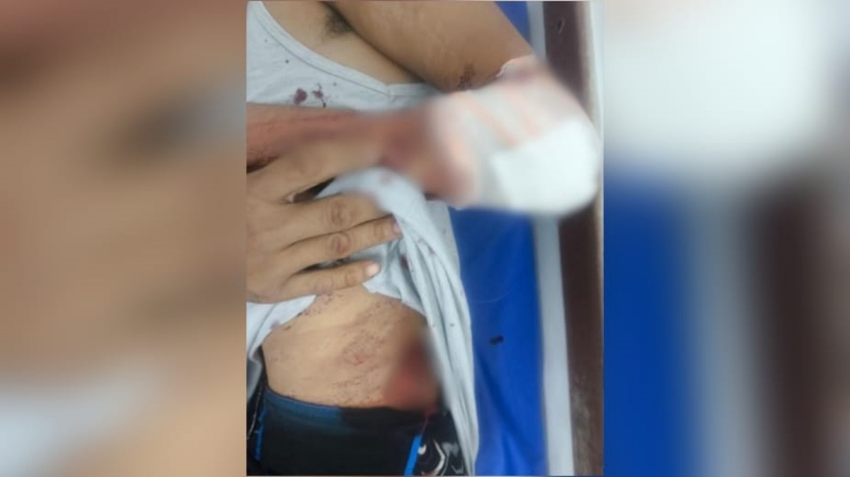 Imagem da vítima ferida