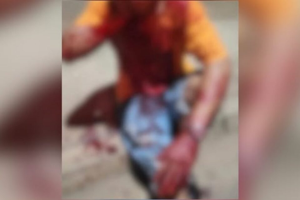 Imagem do homem ensaguentado