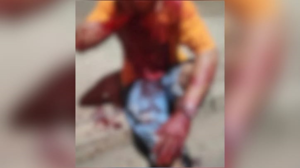 Imagem do homem ensaguentado