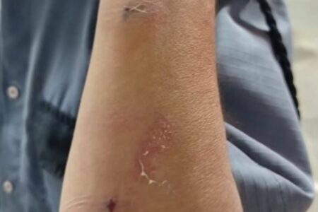 Paciente é suspeita de agredir vigilante em Hospital de Jataí após advertência para não fumar