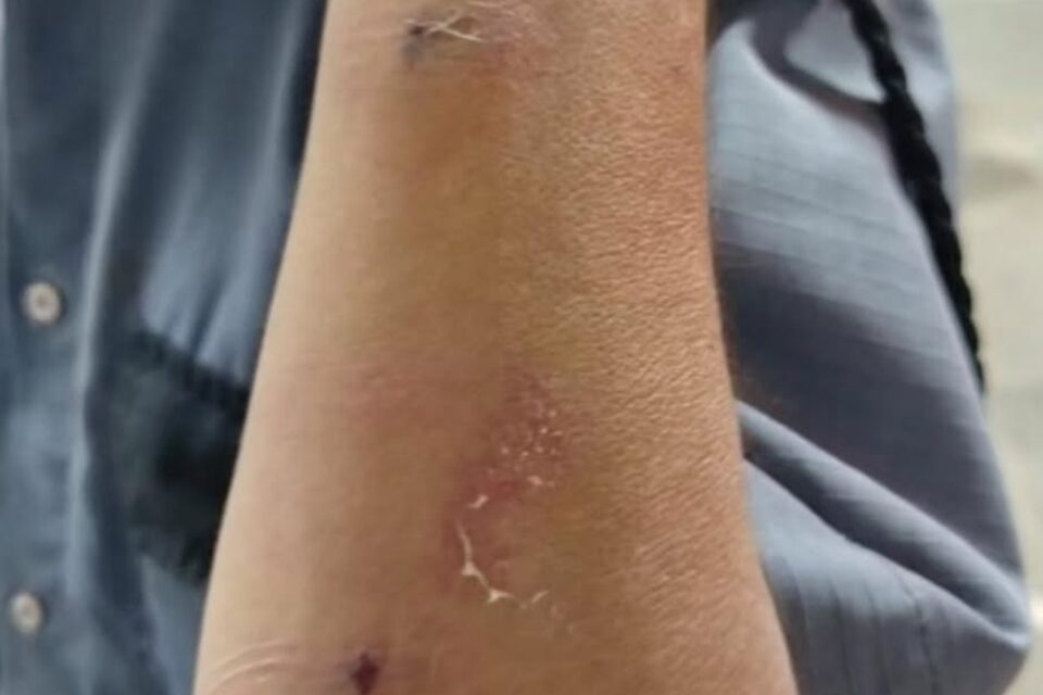 Paciente é suspeita de agredir vigilante em Hospital de Jataí após advertência para não fumar