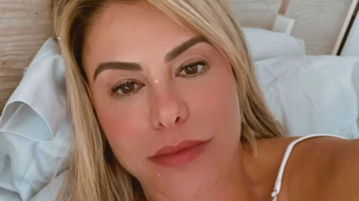 Médico detalha procedimentos feitos no rosto de Poliana Rocha, esposa de Leonardo; veja foto Mãe de Zé foi submetida a vários procedimentos