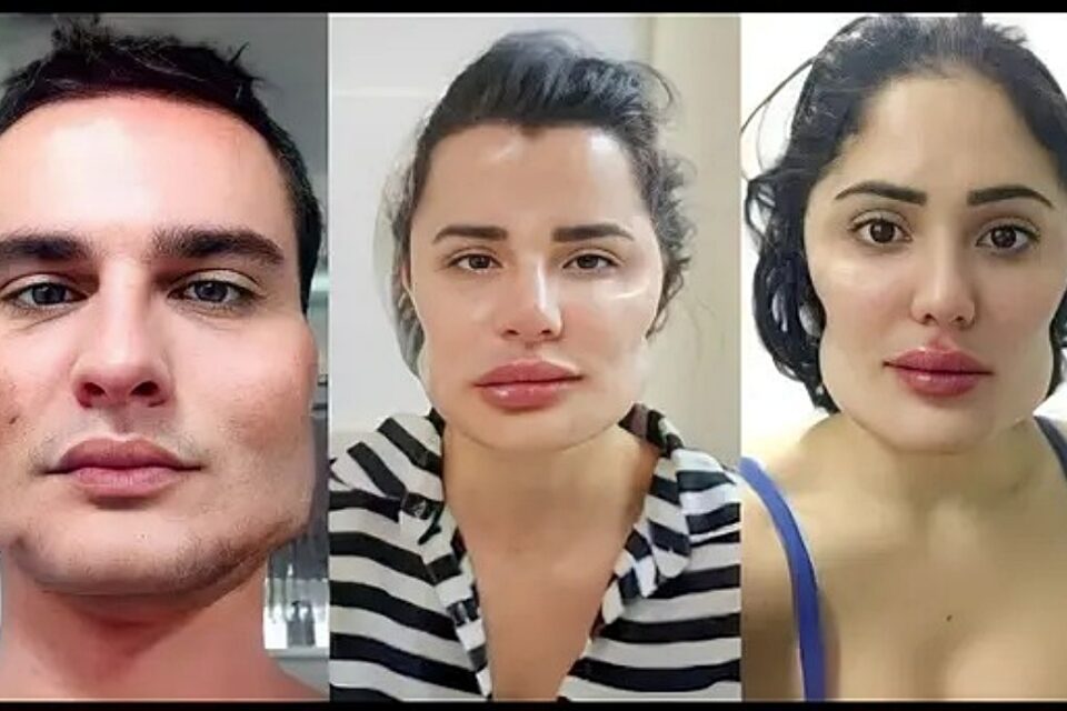 Imagem dos pacientes deformados