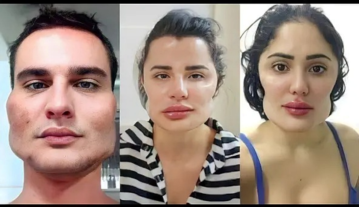 Imagem dos pacientes deformados