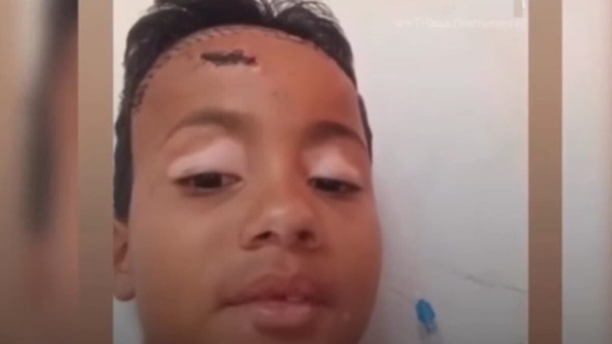 Vídeo: Menino espancado no lugar do irmão em Caldas Novas desperta do coma; família pede ajuda pablo orações