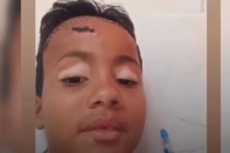 Vídeo: Menino espancado no lugar do irmão em Caldas Novas desperta do coma; família pede ajuda pablo orações