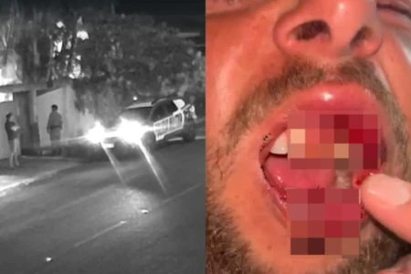 imobilizado por PMs enquanto outro o agredia Morador de Goiandira agredido por PMs após briga política; levou 6 pontos e teve dente quebrado